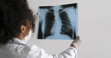 Além do tabagismo, obesidade e inflamação são prejudiciais aos pulmões Além do tabagismo, obesidade e inflamação são prejudiciais aos pulmões